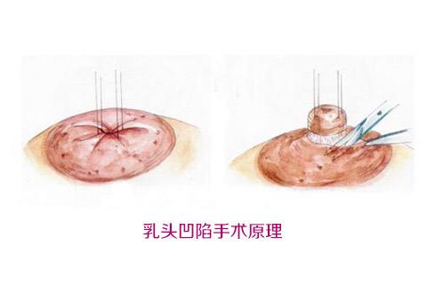 沈陽(yáng)百嘉麗醫(yī)院之汪曉蕾：她的醫(yī)療造詣如何？
