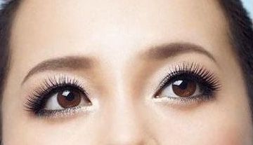 成都嬌點王運平隆胸效果如何？真實案例分享！