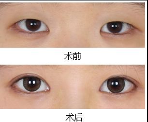 鄭州去黑點(diǎn)哪家醫(yī)院好？揭秘最受歡迎的黑點(diǎn)去除醫(yī)院