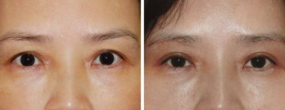 上海激光美容醫(yī)院排名及熱門選擇，哪家好？