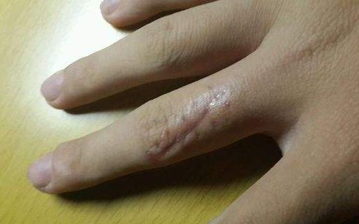 上海哪家醫(yī)院做肋骨鼻子整形手術(shù)好？