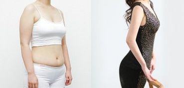 成都做雙眼皮，哪家醫(yī)院專業(yè)可靠？