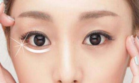 荊州割眼袋哪家醫(yī)院好？眼袋修復(fù)專(zhuān)家為您推薦！