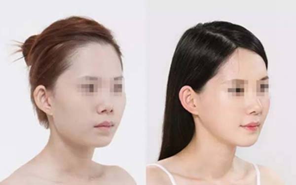 北京隆胸醫(yī)生排行：網(wǎng)友推薦的實力派、口碑出眾的美容專家值得關注