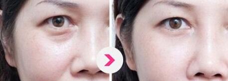 北京哪位醫(yī)生擅長(zhǎng)巨乳縮小手術(shù)？5名實(shí)力醫(yī)生值得推薦