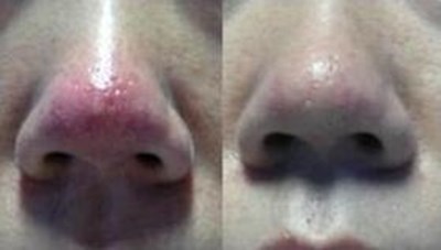 福州哪家醫(yī)生做隆胸技術好？推薦五位專業(yè)醫(yī)師，價格參考！