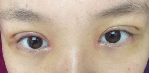 徐州做拉皮哪家醫(yī)院好？一起來看看徐州市最受歡迎的做拉皮醫(yī)院