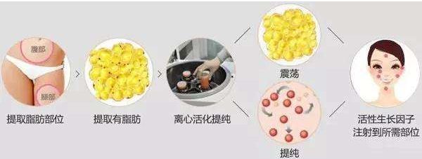 哈爾濱哪家醫(yī)院的去皺針效果好？