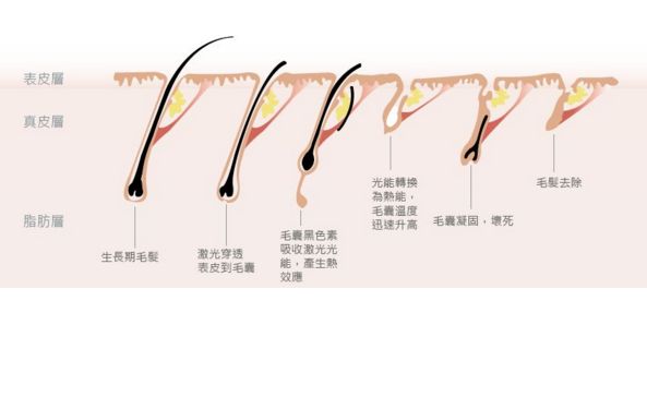 深圳哪家激光祛斑醫(yī)院口碑好？