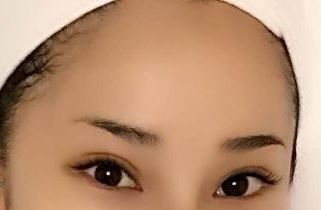 上海醫(yī)院最好治療皮膚疤痕的?？剖悄募?？