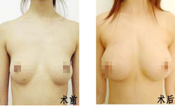 北京景區(qū)楊斌突嘴手術(shù)矯正效果如何？從個(gè)人實(shí)力和大眾評(píng)價(jià)來(lái)分析