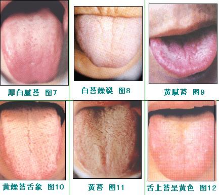 2023株洲眼紋微創(chuàng)提升排名榜top10專家(謝磊、張臘林、陳守正強烈來襲)