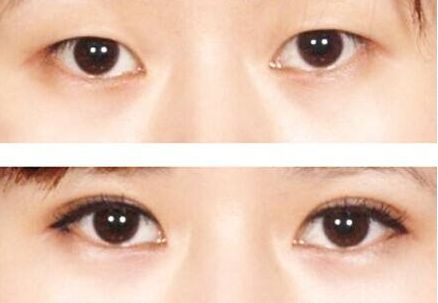 榆林市美容哪家醫(yī)院好？榆林市頂級美容醫(yī)院推薦