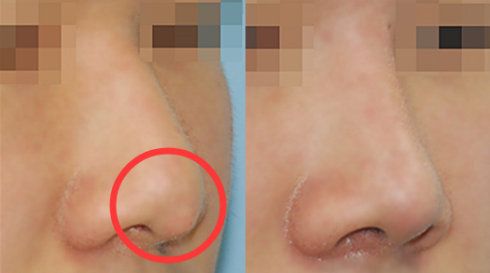 福州哪家醫(yī)院做疤痕好？比較全面的福州疤痕治療醫(yī)院推薦給您！