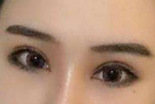 貴陽(yáng)梁安裕醫(yī)生技術(shù)在線解析腹壁成型效果，怎么樣？