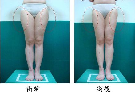 昆明哪家治痘痘好的醫(yī)院，痘痘問題如何有效解決？
