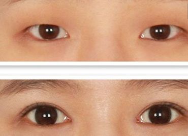 鄭州哪家美容醫(yī)院正規(guī)且口碑好？