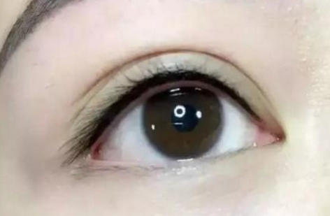 馬桂娥面頰填充脂肪能打造自然輪廓，挺陽高效！醫(yī)生背景介紹必讀！