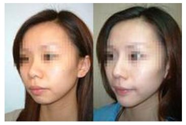 秦皇島美容美體哪家好？刷爆朋友圈的秘密美容院大揭秘！