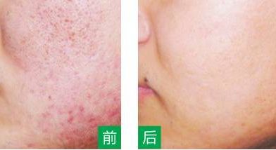 永州美辰醫(yī)療整形醫(yī)院的價(jià)格如何？收費(fèi)標(biāo)準(zhǔn)透明公開，術(shù)前注意事項(xiàng)必看！