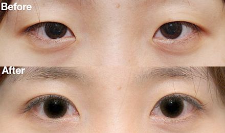 2023廣州玻尿酸面部皺紋填充專家綜合實力排行榜(李政祐、陳美運、羅曉慧這些醫(yī)生名氣都很大！)