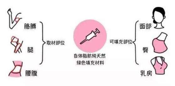 成都潘紅偉吸脂手術(shù)效果如何？專家解讀！