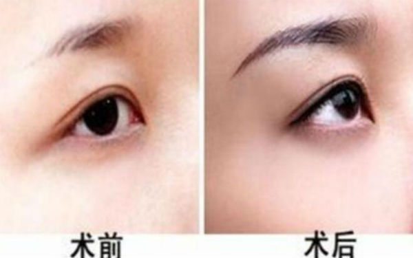 西京醫(yī)院超贊整形醫(yī)生與驚人隆鼻案例，受歡迎至極！