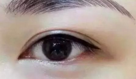 開封華億醫(yī)療美容門診部的醫(yī)生口碑怎么樣？