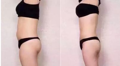 石家莊整容整形醫(yī)院哪家好？全面評(píng)測(cè)幫您選擇最佳醫(yī)療機(jī)構(gòu)！
