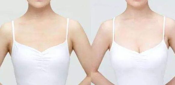 威海假體豐胸醫(yī)院哪家好？從專家口碑、手術(shù)效果看威海頂級醫(yī)院推薦！