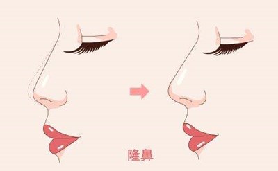 2023重慶膠原蛋白填充面部強榜前10名的專家(陳鵬、楊藝、蔣思軍這幾家技術(shù)高超價格低)