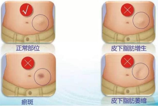 哈爾濱整形醫(yī)院哪家好？選擇哈爾濱整容醫(yī)院前必知的五大關(guān)鍵點(diǎn)