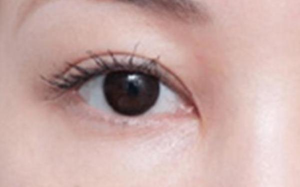 廣州哪家醫(yī)院做隆胸手術(shù)技術(shù)高？醫(yī)生資深經(jīng)驗來看詳細(xì)介紹！