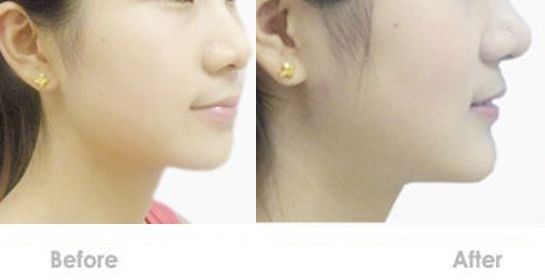 蘇州嘴唇改薄哪家醫(yī)院好？專業(yè)的整形醫(yī)院推薦