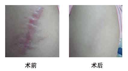 2023淮北光子點(diǎn)痣專家評價(jià)前十強(qiáng)(劉家賀、方芹、任學(xué)東內(nèi)行直呼)