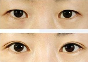 上海治療青春痘的專家推薦，哪家醫(yī)院效果最佳？