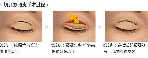 淮安光子嫩膚醫(yī)院哪家好？專家為您推薦5家權(quán)威醫(yī)院