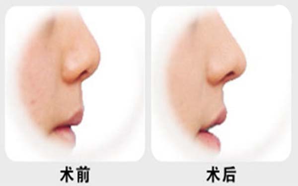 上海專業(yè)唇部整形五大口碑專家公布，人氣名醫(yī)張余光、周佳、戴傳昌等榜上有名