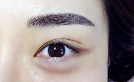 銀川有哪些專業(yè)的激光祛痘印醫(yī)院值得推薦？