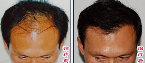 榆林醫(yī)專附屬醫(yī)院醫(yī)學整形美容中心怎么樣？榆林醫(yī)專附屬醫(yī)院醫(yī)學整形美容中心簡介|醫(yī)生團隊|口碑評價！