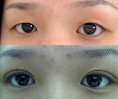 濟(jì)南哪家整形醫(yī)院的拉皮效果好且價格合適？