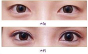 合肥美白針哪家醫(yī)院好？排名前幾位的合肥專業(yè)美膚診所推薦