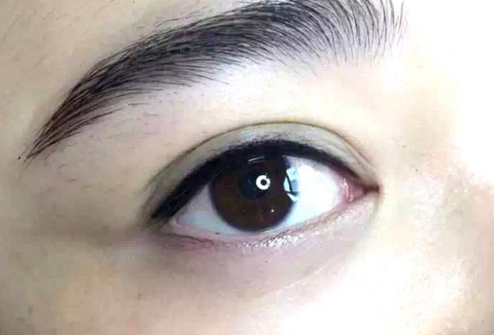 長春市哪家眼科醫(yī)院的專家技術過硬且價格合理？眼睛修復不求名醫(yī)，只求真材實料！