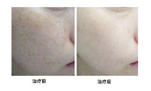 2023保定鼻子歪矯正正規(guī)醫(yī)生評(píng)分前幾(叢相文、高義豆、崔立龍解鎖前三名~)