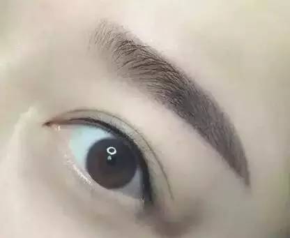 佰華利董萍的面部脂肪填充經(jīng)驗(yàn)，展現(xiàn)自然少女感