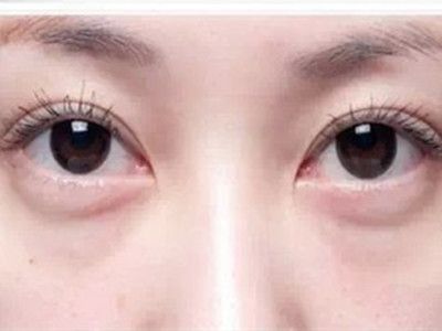 寧波祛斑哪家醫(yī)院好？精選寧波祛斑專業(yè)醫(yī)院推薦！