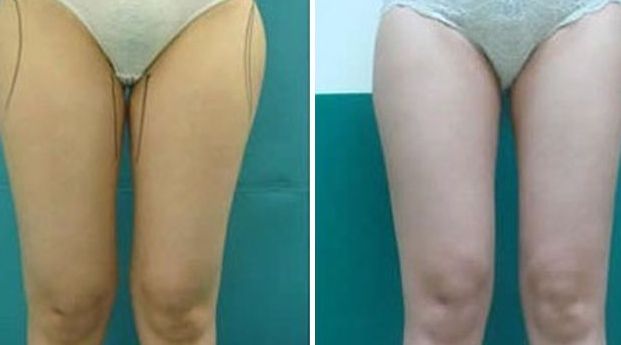 揭陽激光美容醫(yī)院哪家好？選擇揭陽最佳激光美容醫(yī)院的7個(gè)關(guān)鍵要素！