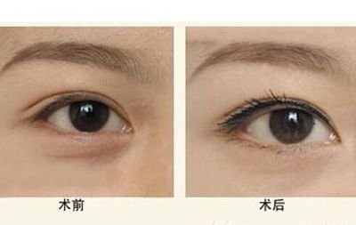 寧波隆鼻Top5醫(yī)生：技術精湛，聲譽卓越，口碑贊不絕口！