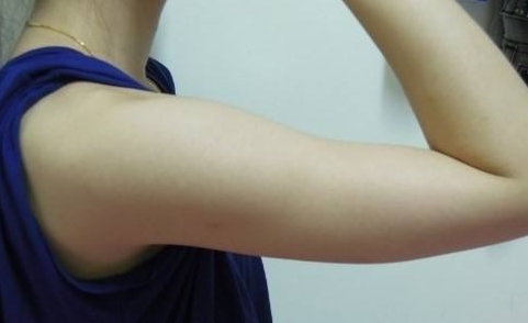 趙寅局拉皮：口碑何如？經(jīng)歷、擅長(zhǎng)和用戶反饋來說話！
