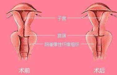 長(zhǎng)沙靠譜矯正醫(yī)院哪家好？解答你所有的疑慮！